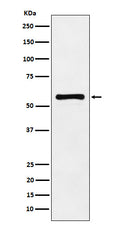 Western blot analysis of PAK2 expression in HeLa cell lysate.
