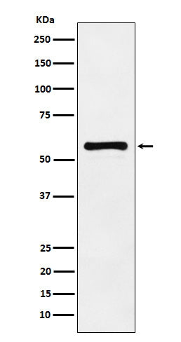 Western blot analysis of PAK2 expression in HeLa cell lysate.