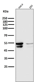 Anti-Cytokeratin 8 KRT8 Rabbit Monoclonal Antibody