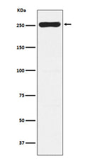 Western blot analysis of WNK1 expression in Saos-2 cell lysate.