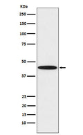 Western blot analysis of DDB2 expression in HeLa cell lysate.