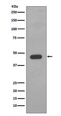 Western blot analysis of Cytokeratin 14 expression in A431 cell lysate.