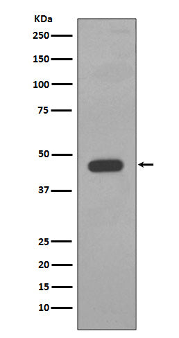 Western blot analysis of Cytokeratin 14 expression in A431 cell lysate.