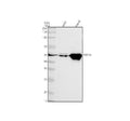 Anti-Cytokeratin 14 KRT14 Rabbit Monoclonal Antibody