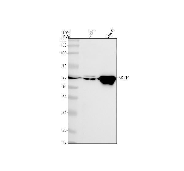 Anti-Cytokeratin 14 KRT14 Rabbit Monoclonal Antibody