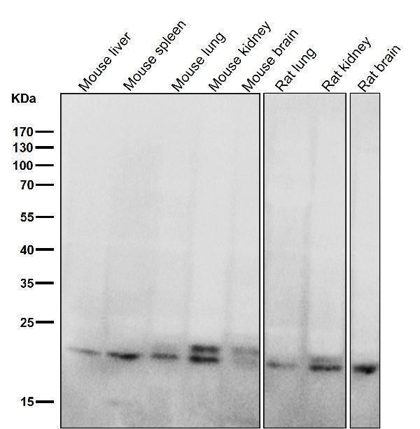 All lanes use the Antibody at 1:5K dilution for 1 hour at room temperature.