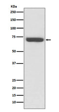 Western blot analysis of TNF Receptor II expression in Jurkat cell lysate.