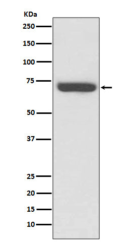 Western blot analysis of TNF Receptor II expression in Jurkat cell lysate.