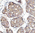 Anti-GC1q R Rabbit Monoclonal Antibody