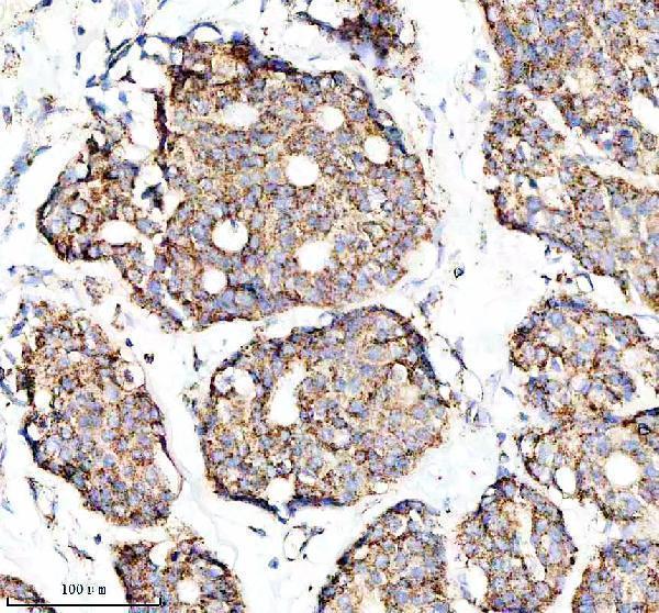 Anti-GC1q R Rabbit Monoclonal Antibody