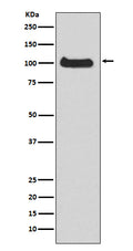 Western blot analysis of PKC mu expression in HeLa cell lysate.