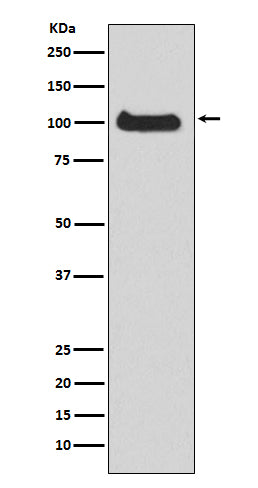 Western blot analysis of PKC mu expression in HeLa cell lysate.