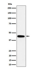 Western blot analysis of GALT expression in K562 cell lysate.