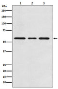 Western blot analysis of ACVRL1 expression in (1) Jurkat cell lysate; (2) Mouse kidney lysate; (3) Rat kidney lysate.