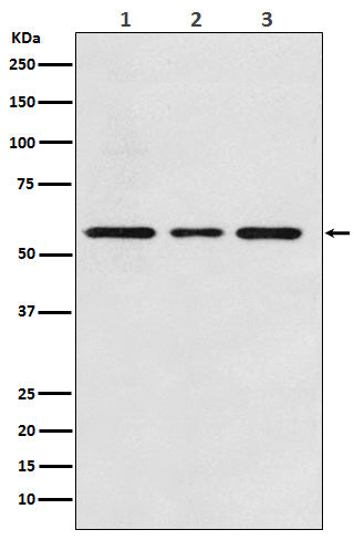 Western blot analysis of ACVRL1 expression in (1) Jurkat cell lysate; (2) Mouse kidney lysate; (3) Rat kidney lysate.
