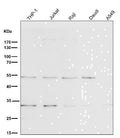All lanes use the Antibody at 1:1K dilution for 1 hour at room temperature.
