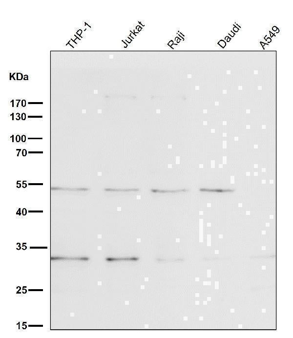 All lanes use the Antibody at 1:1K dilution for 1 hour at room temperature.