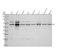 Anti-S6K1 RPS6KB1 Rabbit Monoclonal Antibody
