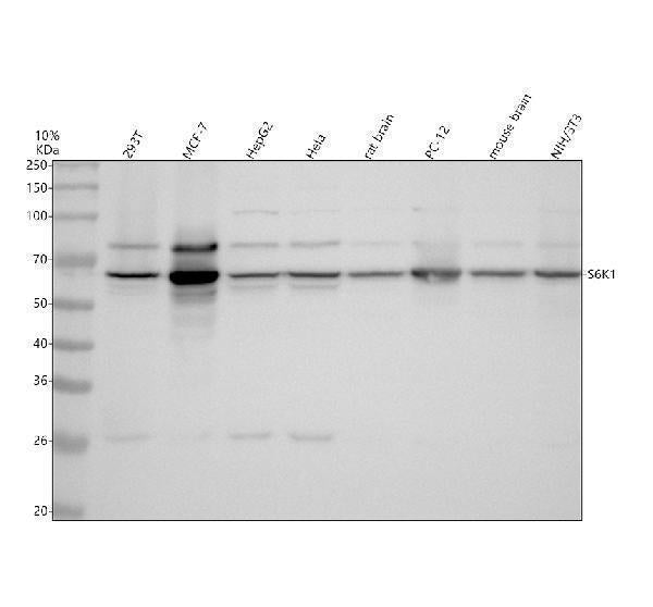Anti-S6K1 RPS6KB1 Rabbit Monoclonal Antibody
