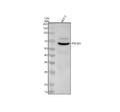 Anti-p70 S6 Kinase RPS6KB1 Rabbit Monoclonal Antibody