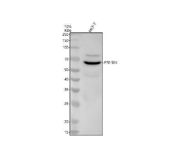 Anti-p70 S6 Kinase RPS6KB1 Rabbit Monoclonal Antibody