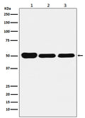 Western blot analysis of GLUR expression in (1) HeLa cell lysate; (2) Mouse brain lysate; (3) Rat kidney lysate.
