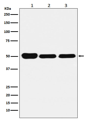 Western blot analysis of GLUR expression in (1) HeLa cell lysate; (2) Mouse brain lysate; (3) Rat kidney lysate.