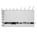 Anti-Profilin1 PFN1 Rabbit Monoclonal Antibody