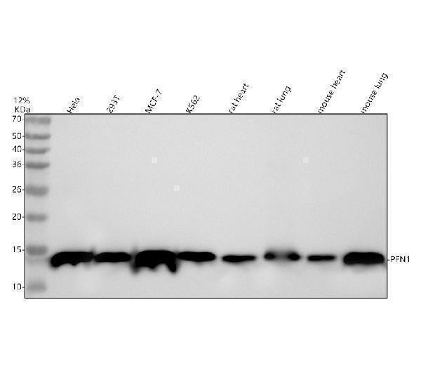 Anti-Profilin1 PFN1 Rabbit Monoclonal Antibody