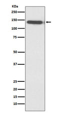 Western blot analysis of Ctip2 expression in Jurkat cell lysate.