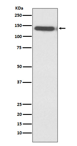 Western blot analysis of Ctip2 expression in Jurkat cell lysate.
