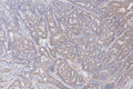 Anti-Met (c-Met) Rabbit Monoclonal Antibody