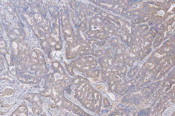 Anti-Met (c-Met) Rabbit Monoclonal Antibody