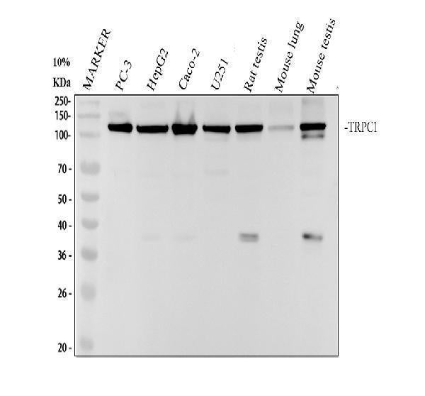Anti-TRPC1 Rabbit Monoclonal Antibody