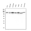 Anti-Hexokinase 1/HK1 Antibody Picoband® (monoclonal, 4B7)