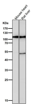 All lanes use the Antibody at 1:1W dilution for 1 hour at room temperature.