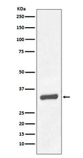 Western blot analysis of PSA/KLK3 expression in Human prostate carcinoma tissue lysate.