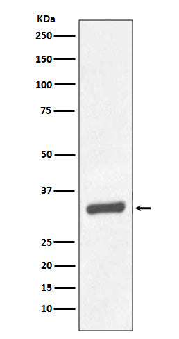 Western blot analysis of PSA/KLK3 expression in Human prostate carcinoma tissue lysate.