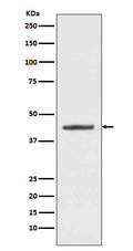 Western blot analysis of HMBS expression in HepG2 cell lysate.