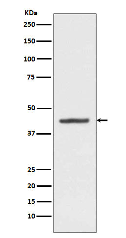 Western blot analysis of HMBS expression in HepG2 cell lysate.