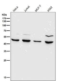 All lanes use the Antibody at 1:1K dilution for 1 hour at room temperature.