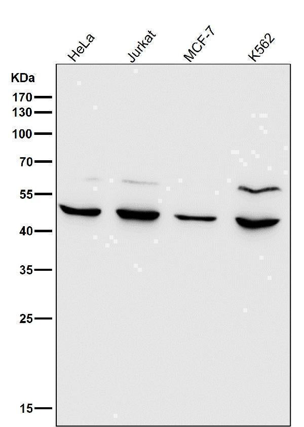 All lanes use the Antibody at 1:1K dilution for 1 hour at room temperature.