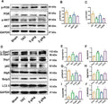 Anti-LC3B MAP1LC3B Rabbit Monoclonal Antibody