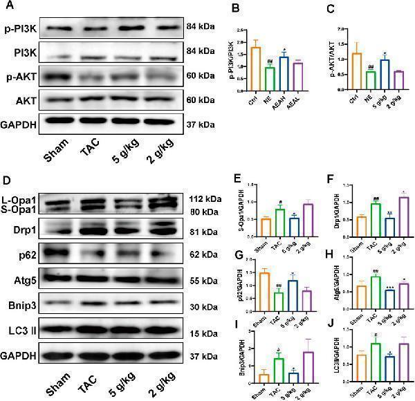 Anti-LC3B MAP1LC3B Rabbit Monoclonal Antibody