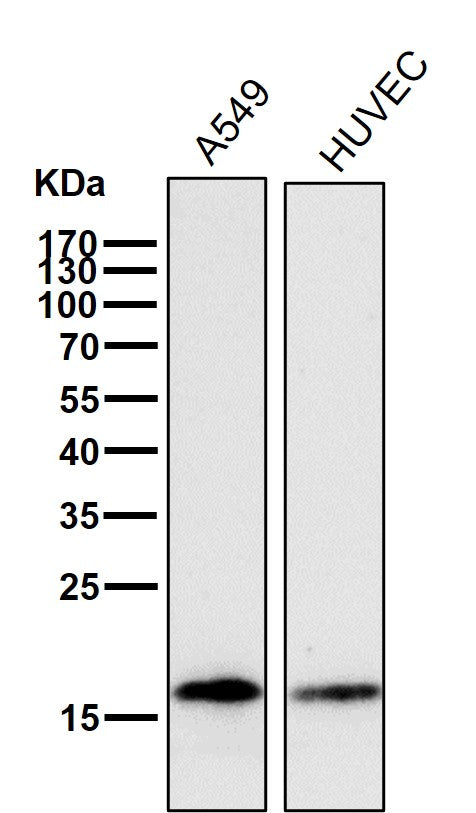 All lanes use the Antibody at 1:1K dilution for 1 hour at room temperature.