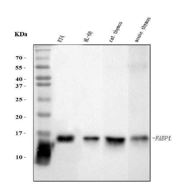 Anti-FABP4 Antibody Picoband® (monoclonal, 10E12)