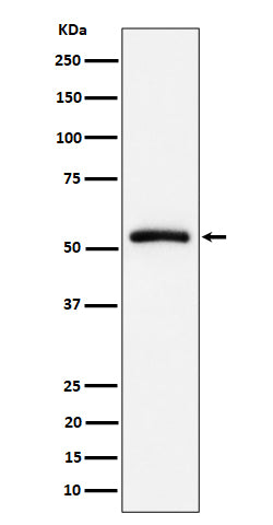 Western blot analysis of CAP1 expression in Raji cell lysate.
