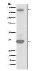Western blot analysis of RON expression in SKBR3 cell lysate.