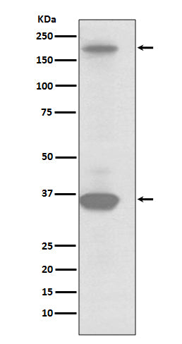 Western blot analysis of RON expression in SKBR3 cell lysate.
