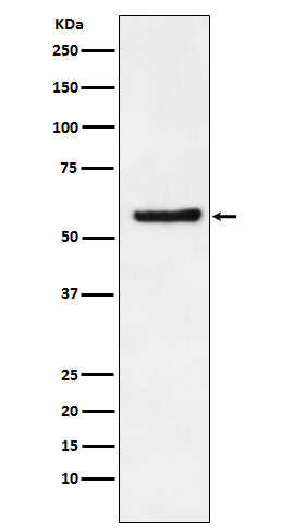 Western blot analysis of DKC1 expression in SW480 cell lysate.